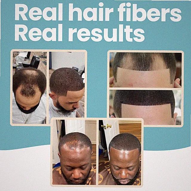 Hair Fibers by HAIR ILLUSION - Baldness & Thinning Hair Treatment for Men, Women